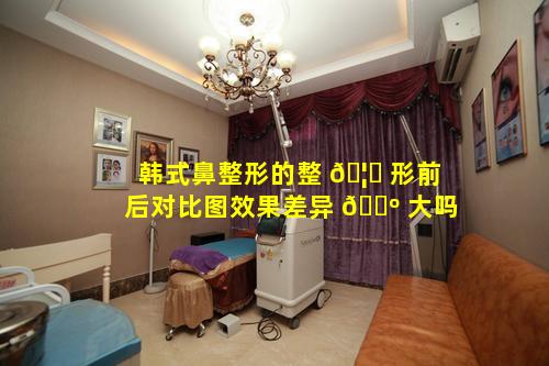 韩式鼻整形的整 🦅 形前后对比图效果差异 🌺 大吗
